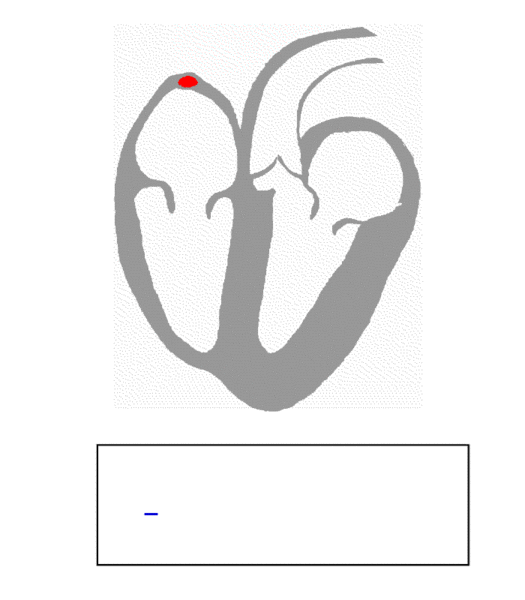 wiki 525px ECG Principle fast Treating YOUR hypertension:Naturally Including Omega 3