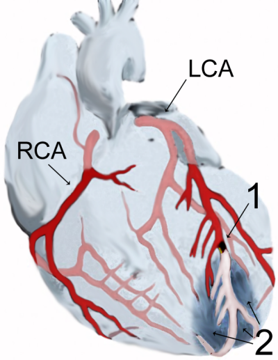 How Is Your Heart?  Omega 3 Can Help Keep It Beating