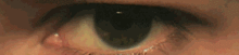 eye exercises